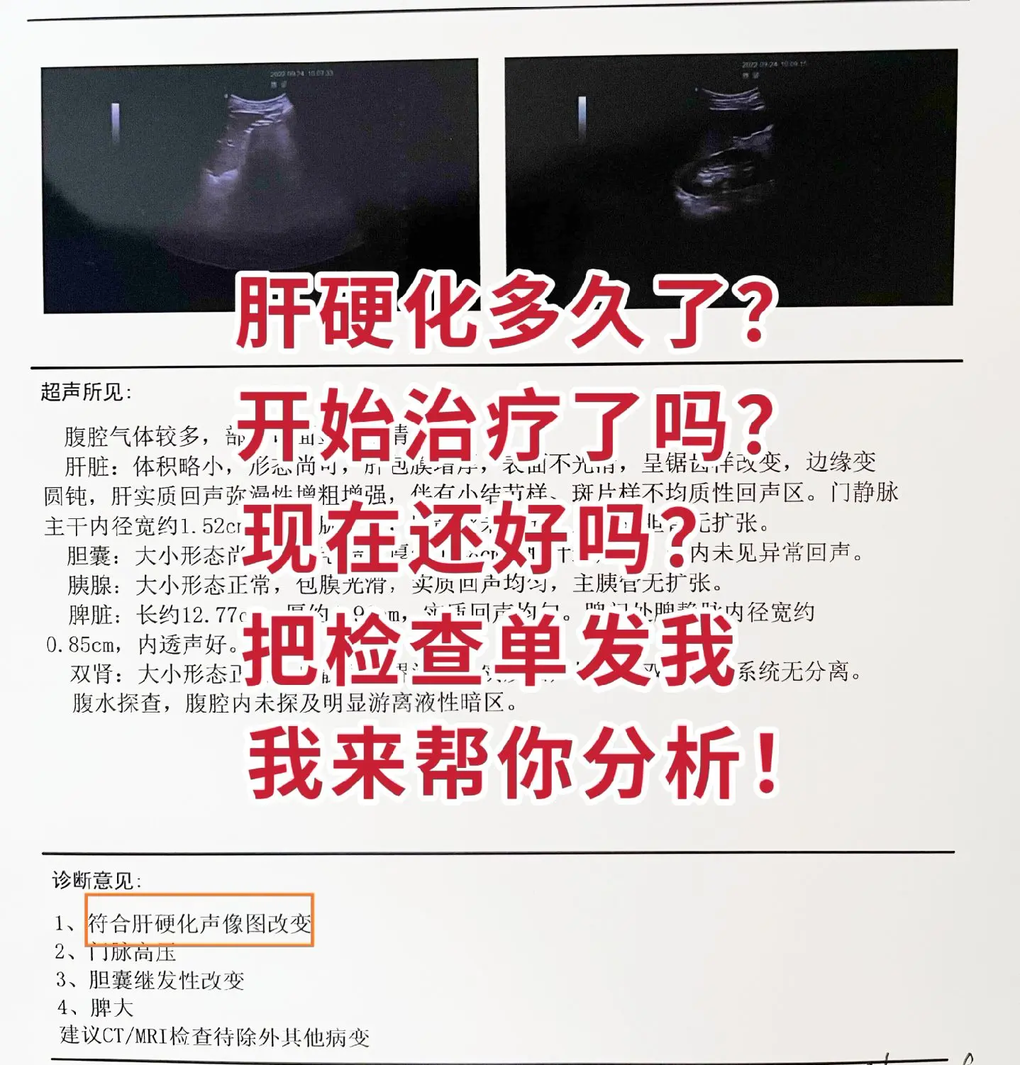 医学科普 肝硬化 图文来了 肝脏彩超 肝病教授陈士俊