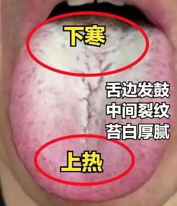 续航短、起不来，不用担心了，一个中成药，打通中焦，专攻上热下寒！

想法多、兴致