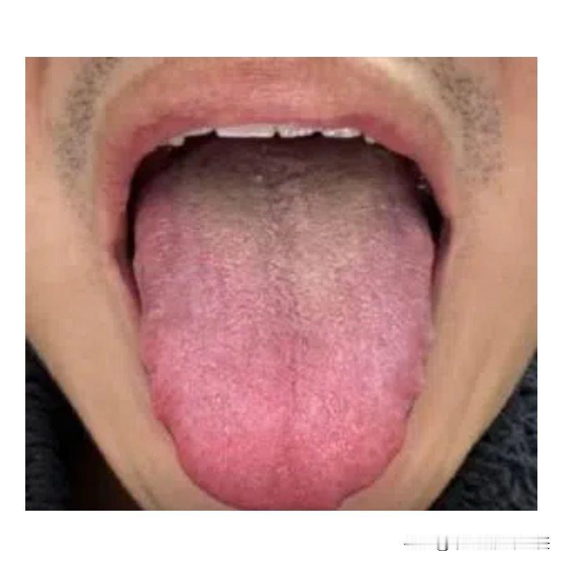 这种舌象拖得越久，问题就越多，想要调理就更麻烦！

为啥这么说呢？我们来看一下这