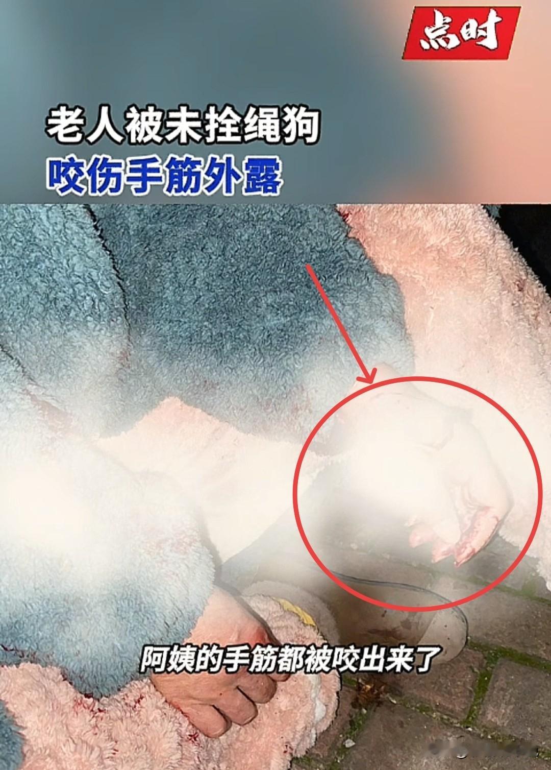 12月9日晚，湖南株洲某小区内传来惨叫，女子打开窗户看见一只大型犬把一位阿姨扑倒