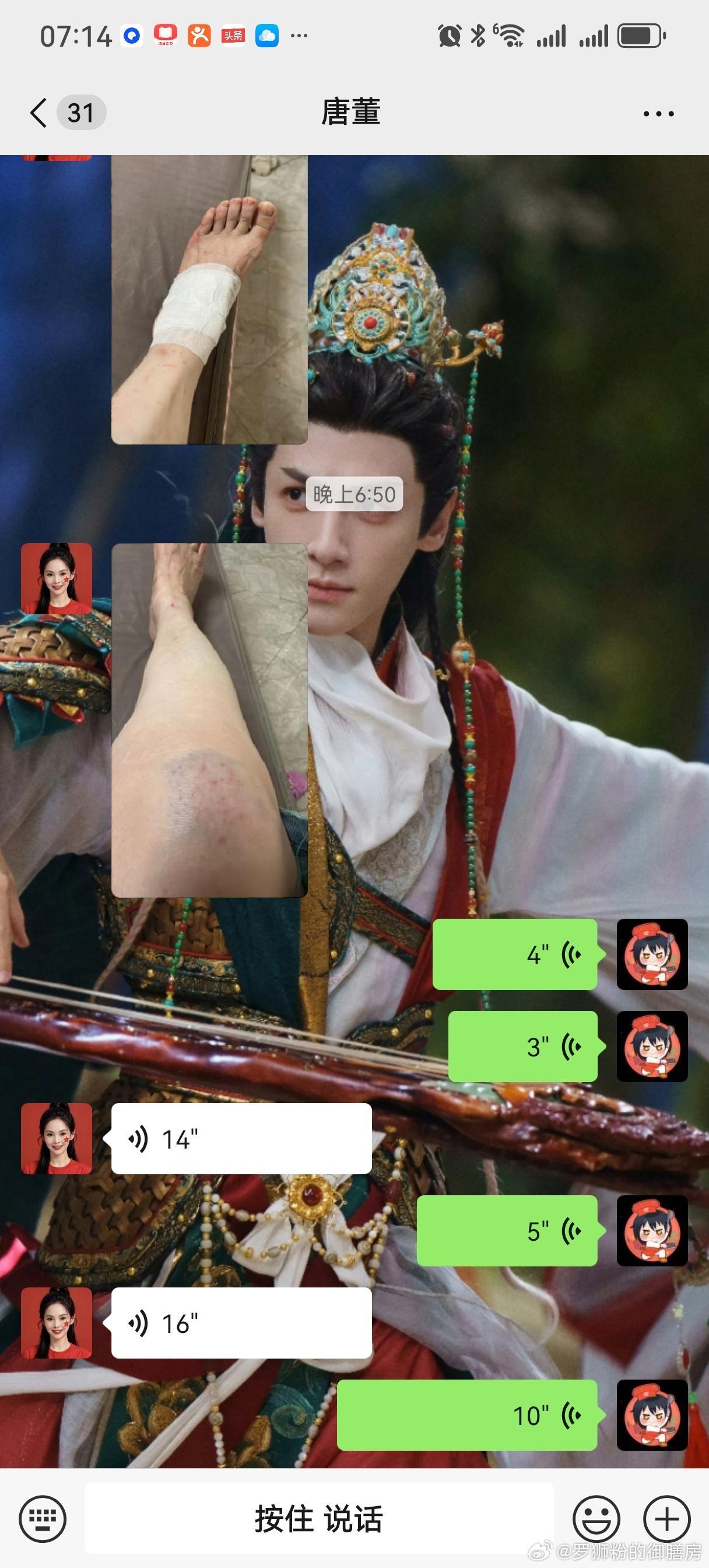 我家BOSS绝对是个倒霉蛋，今天中午我们两个吃饭的时候聊天，说到她两年前这个时候