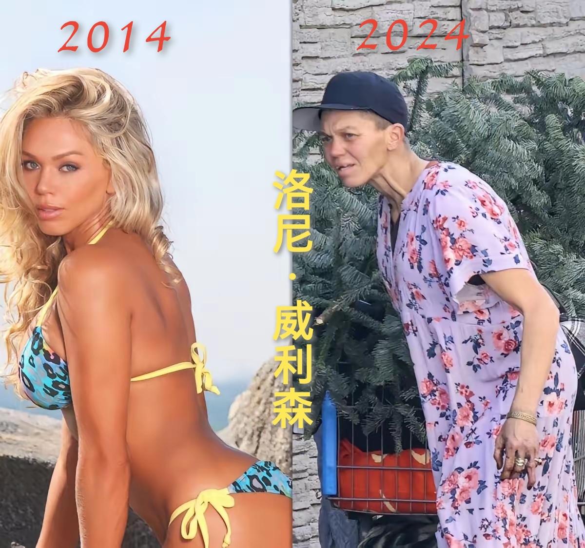你敢相信吗？一个人遭遇不幸后的变化是如此之大！
    曾经性感火辣、身材傲人的