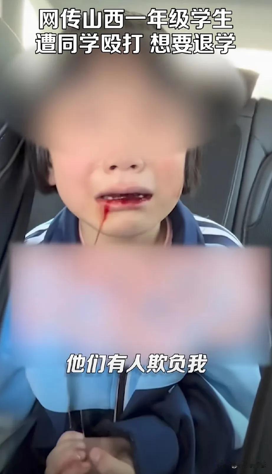 10月15号，山西省晋中市灵石县，几岁的小女孩子上一年级在学校被学生殴打，想要退