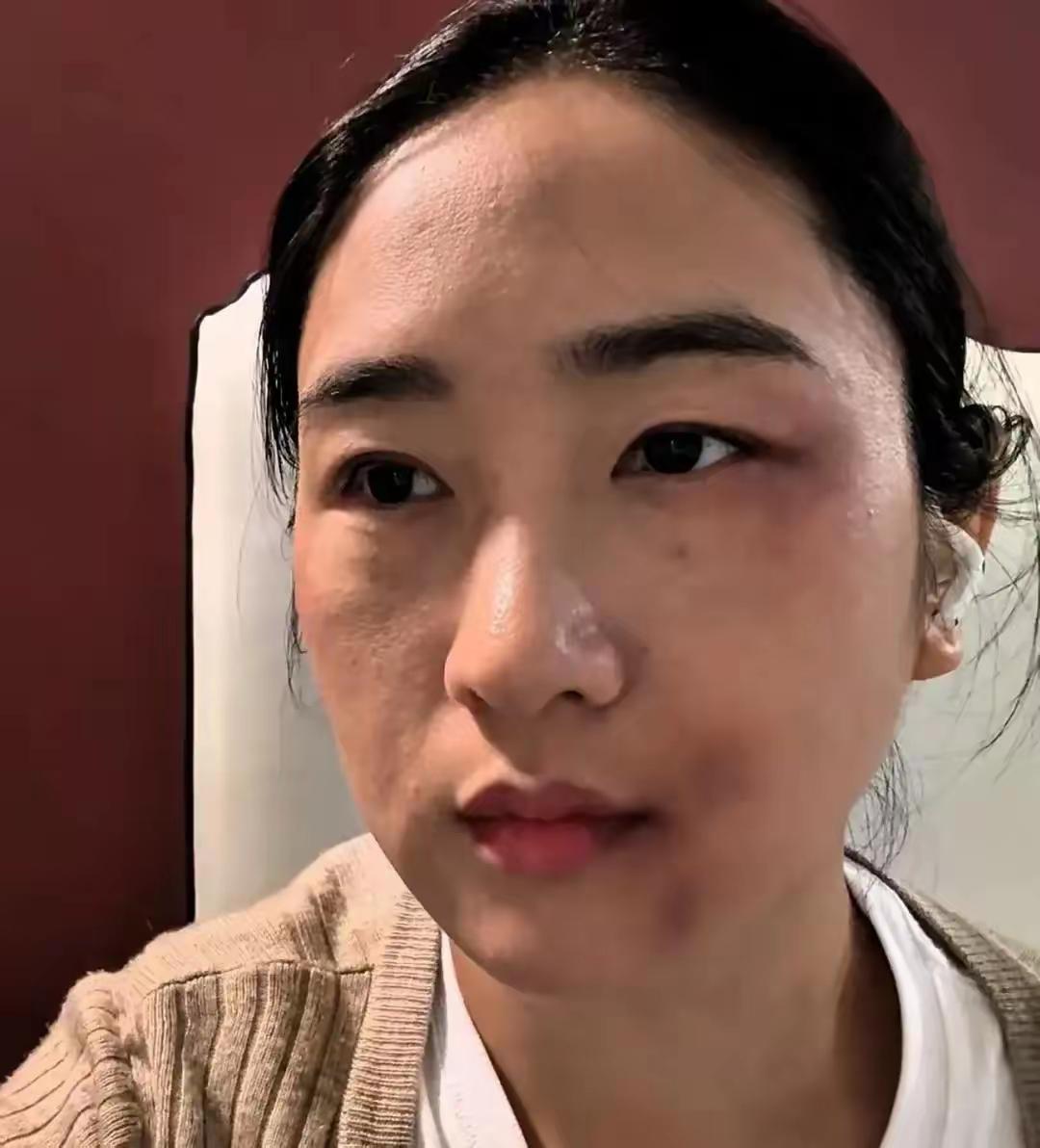 王姐被家暴十几年，前天终于爆发了，她问上初中的儿子 "你爸再打我你帮谁"，儿子头