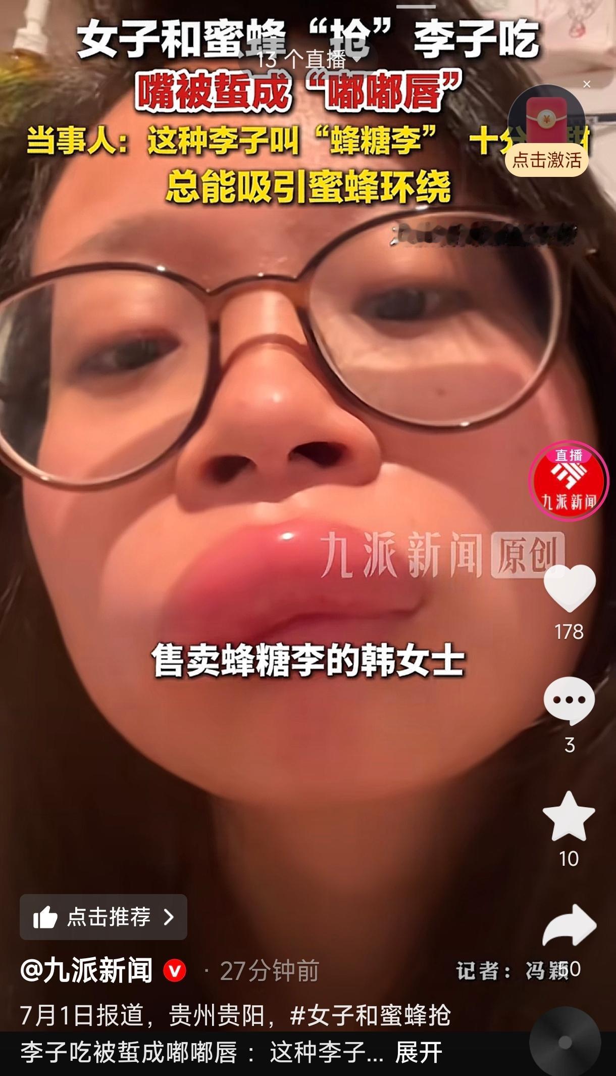 贵州贵阳，一女子卖蜂糖李，与顾客分食品尝，结果招来蜜蜂抢食，把她的上嘴唇狠狠蛰了