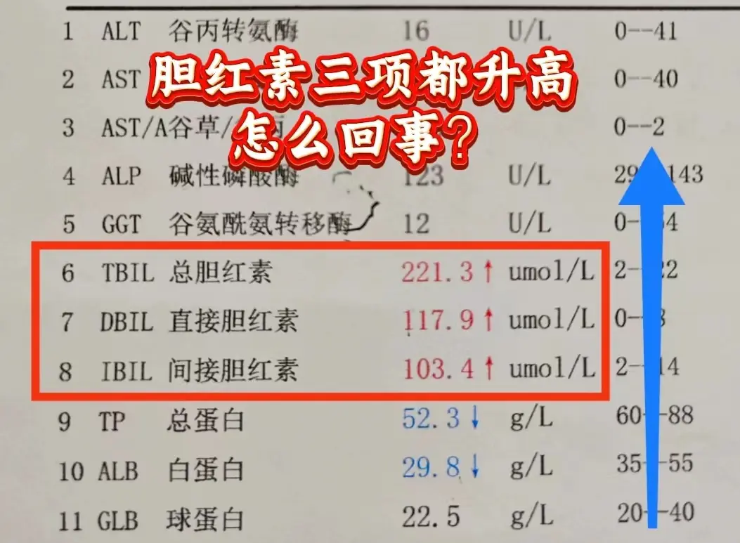 胆红素是一般情况下总胆红素的正常值为0~26μmol/L；直接胆红素为...