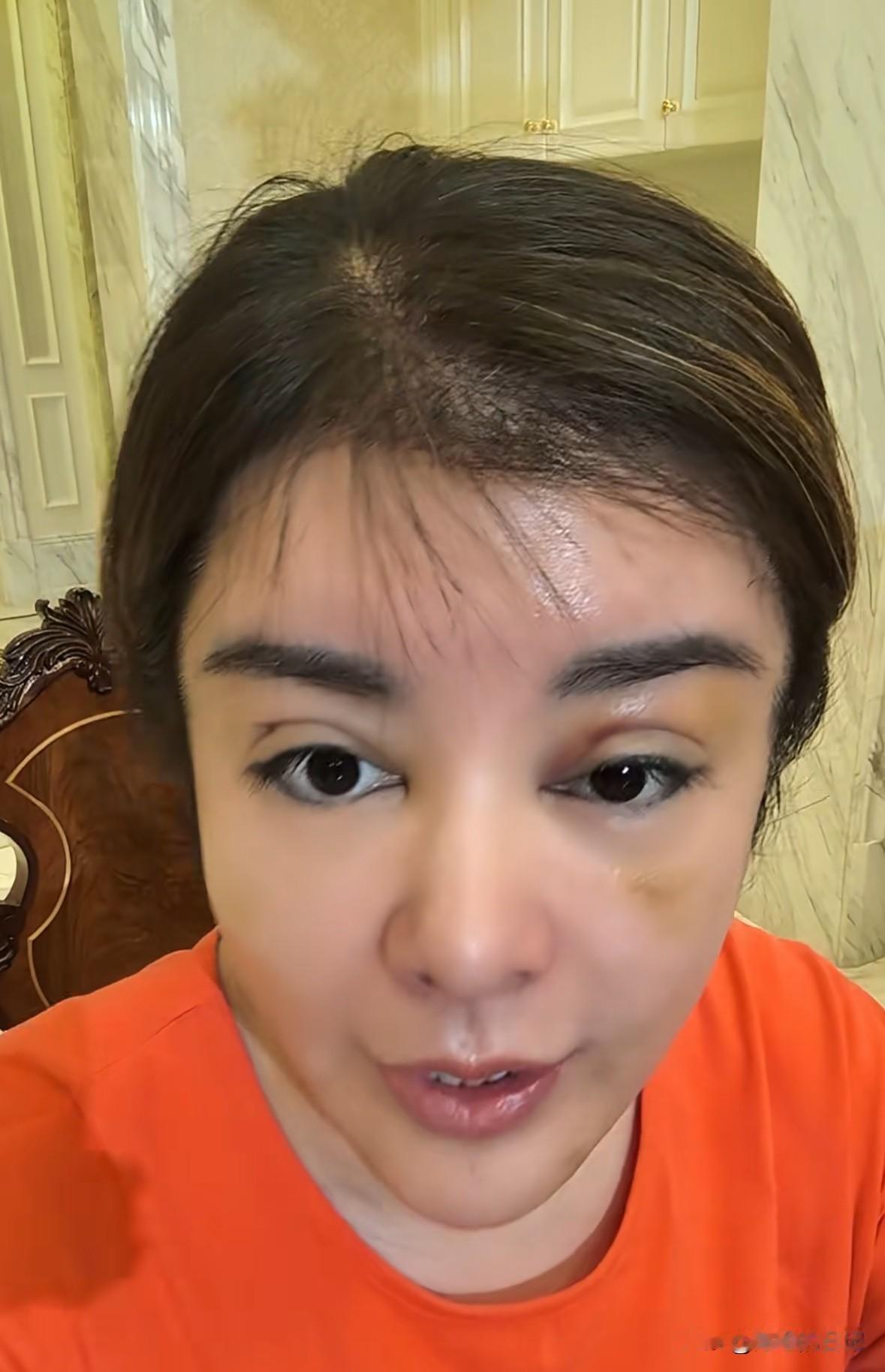 粉丝说于文红“你很缺爱”
于文红说“我有很多爱，要不我让你看看？我有很多男朋友，