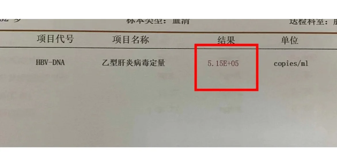 查出乙肝，少做这两件事，否则肝脏越来越坏
