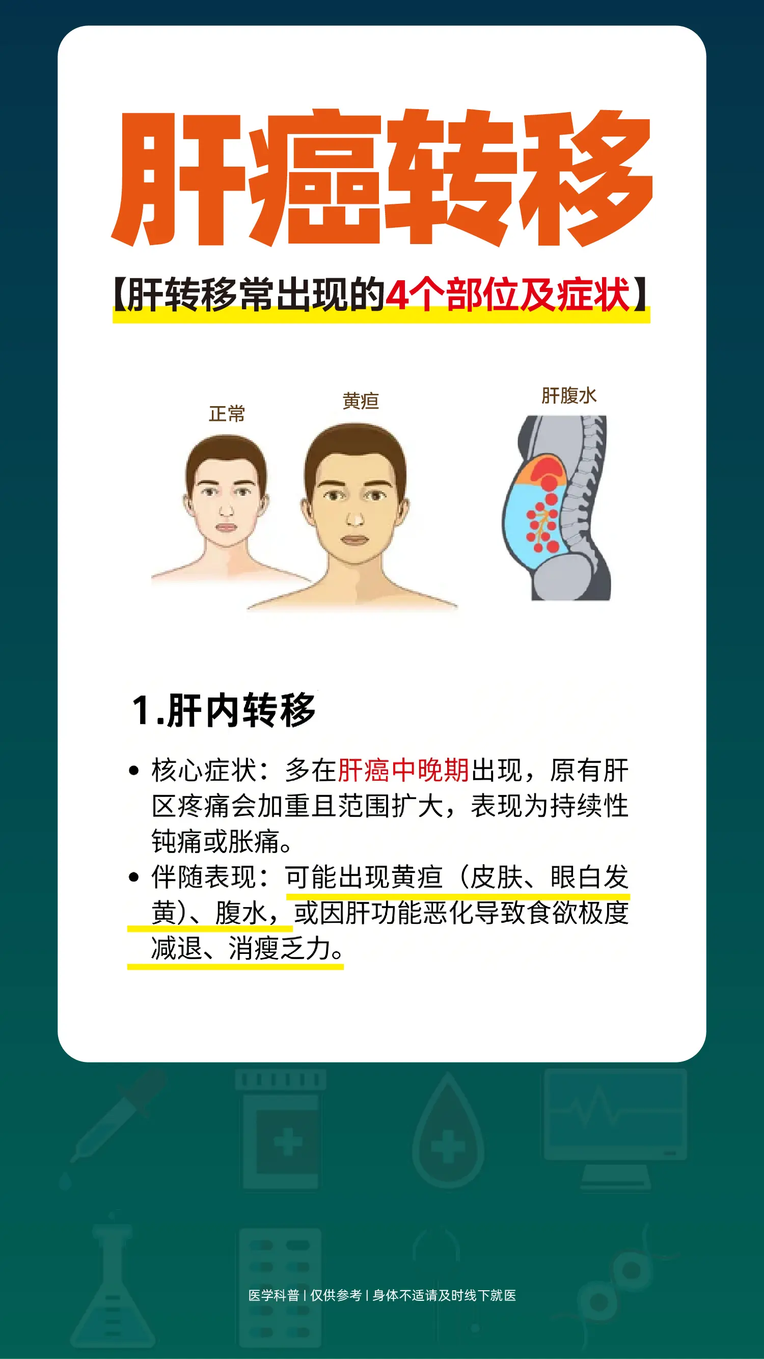 肝癌转移常出现的4个部位。