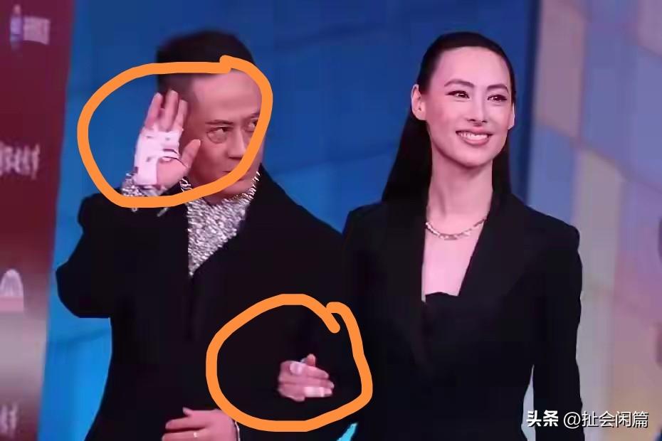 弱弱的问一句，这两只受伤的手是造型啊，还是真的受伤了？

梁洛施挽着男友马浴柯出