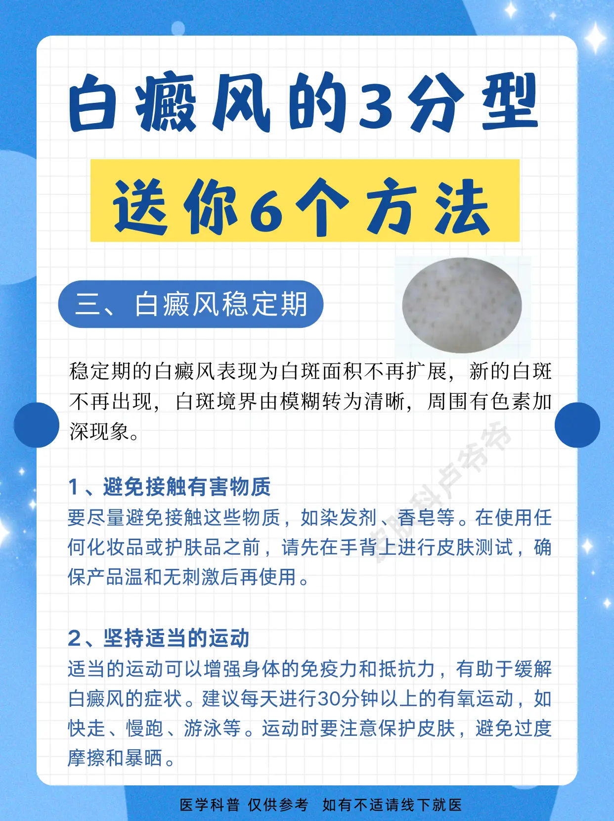白癜风的3分型 你是哪个？