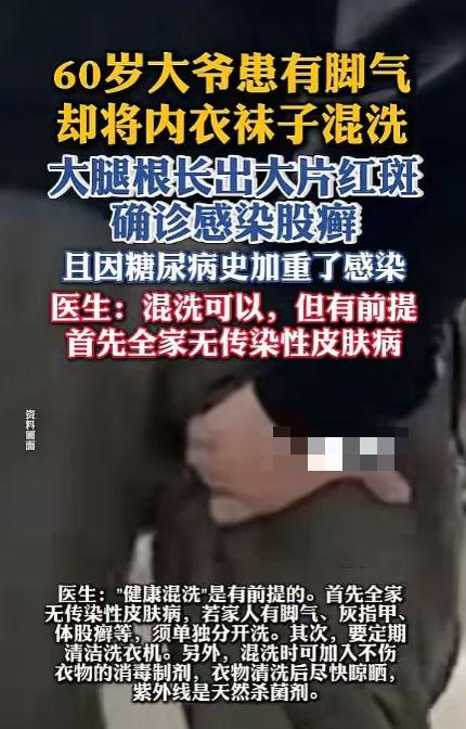 “悲剧还是发生了！”河南郑州，一大爷患有脚气，却喜欢将内衣袜子一起混洗，结果大腿