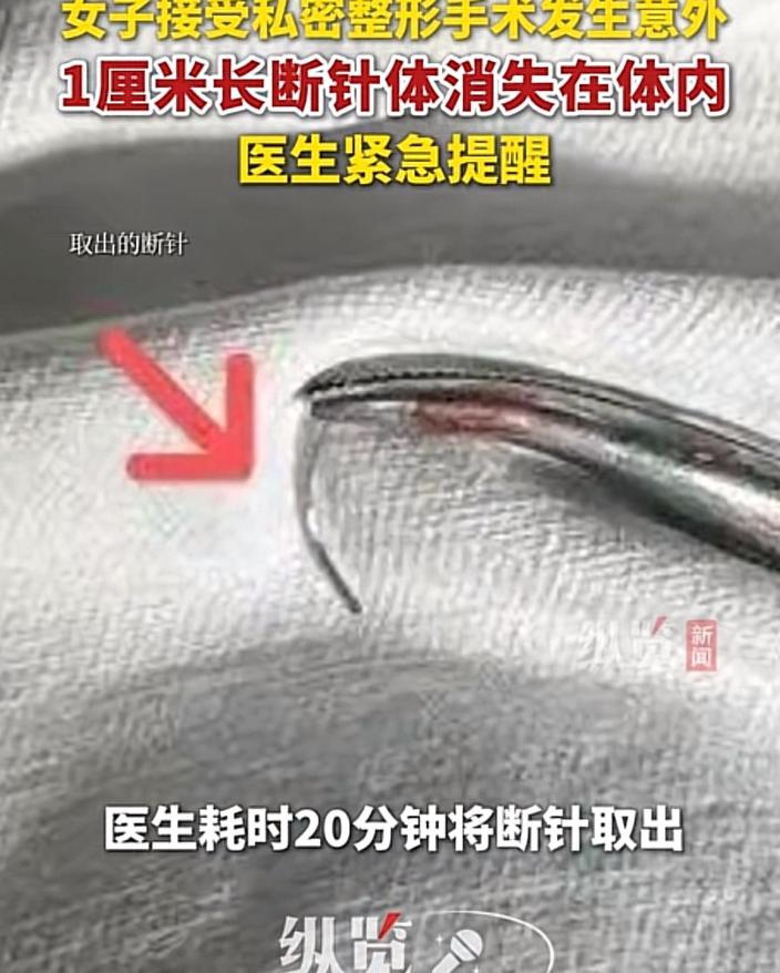 “替她捏了一把汗！”浙江，一女子生完孩子后，担心被丈夫嫌弃，于是，到一家私立美容