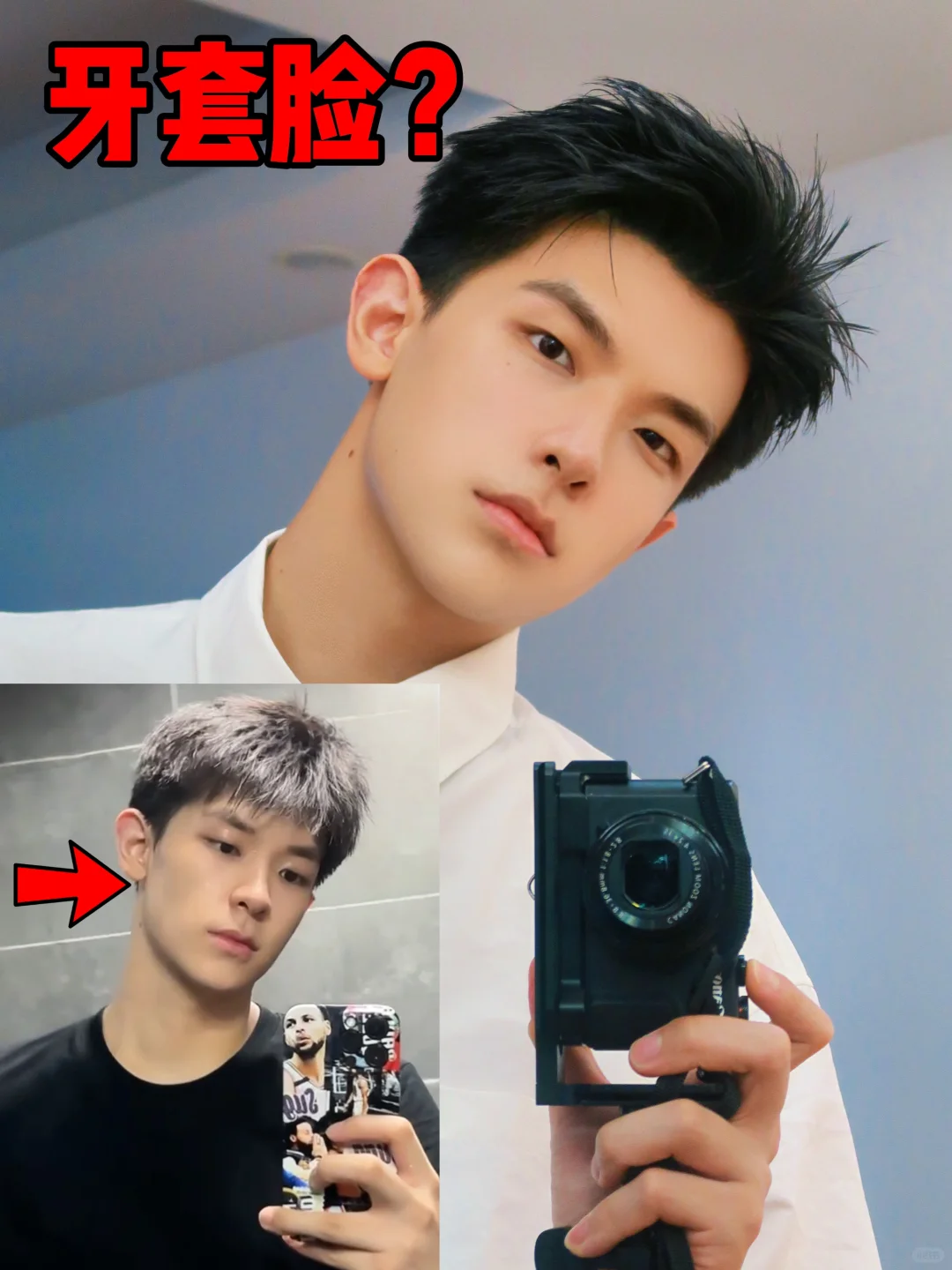 戴隐形牙套两年 脸型真实变化分享😱