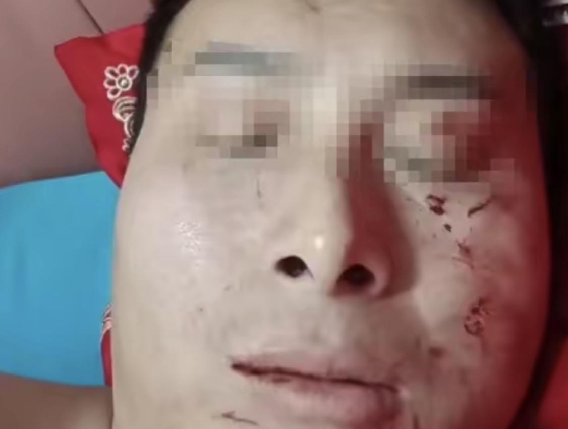 四川达州，38岁男子经媒人介绍小8岁女子，相处了一段时间就结婚了。谁知，新婚当晚