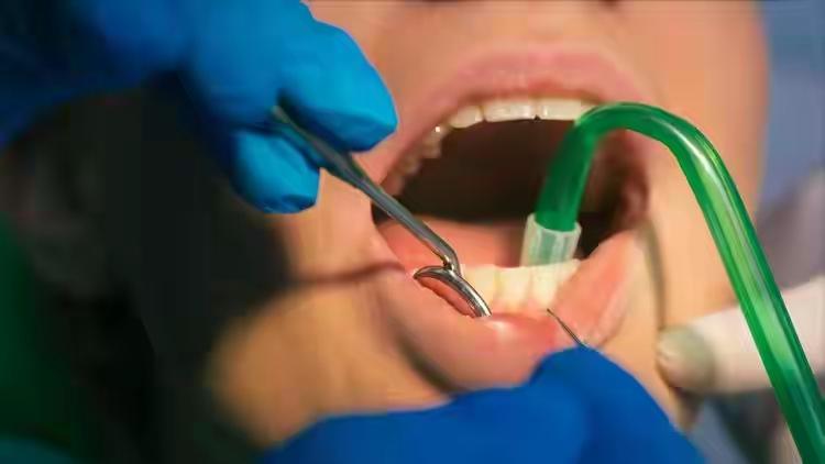 26岁小伙拔智齿后血流不止，10天后身亡！拔智齿为何这么凶险？

26岁的程序员