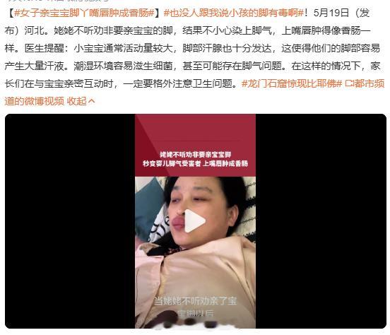 女子亲宝宝脚丫嘴唇肿成香肠 我的天...还真的第一次听说宝宝的脚不能亲OK，不单