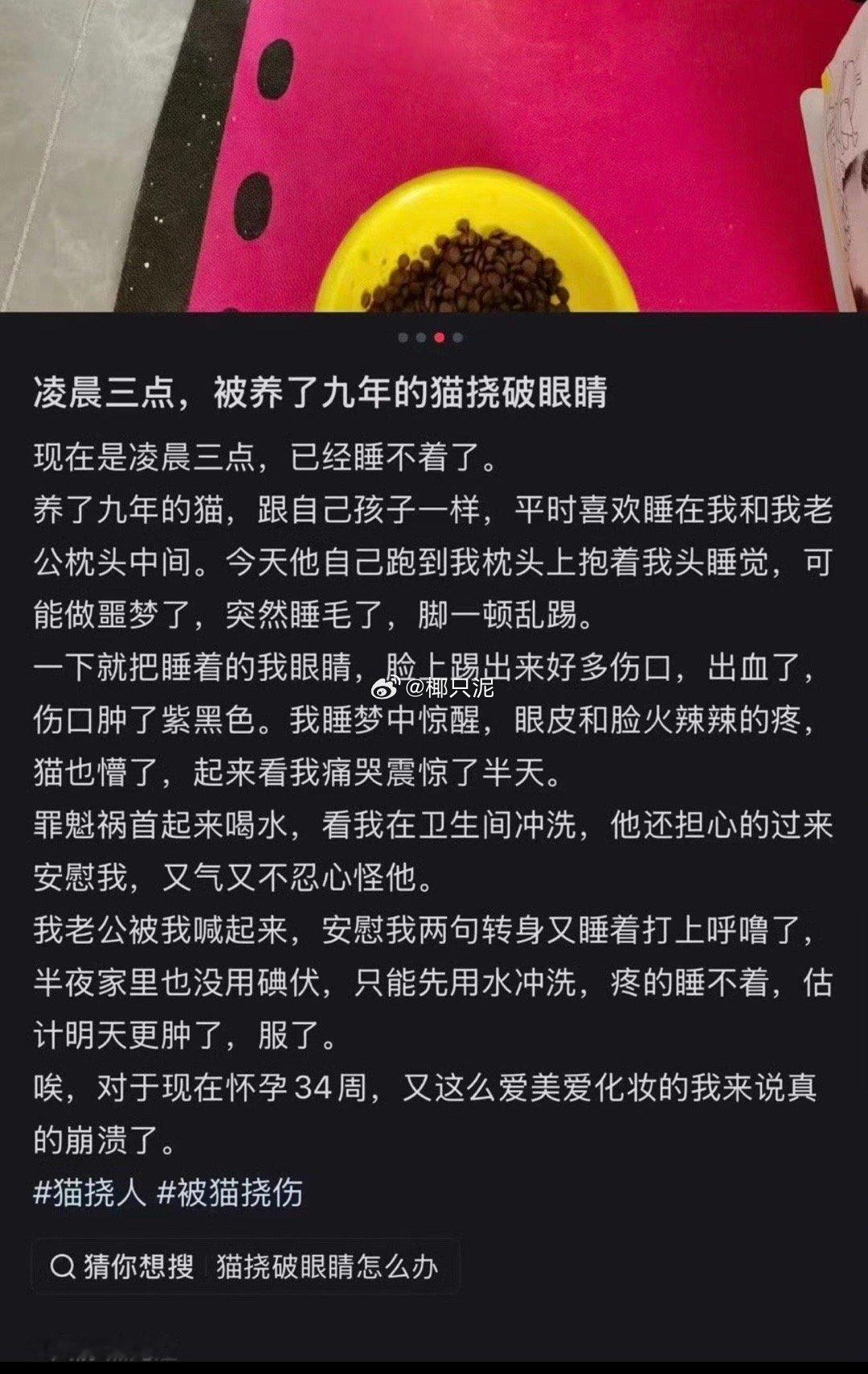 太典了 怀孕34周被猫不小心抓伤流血 她老公起来问一句就接着睡觉了 还要替她老公