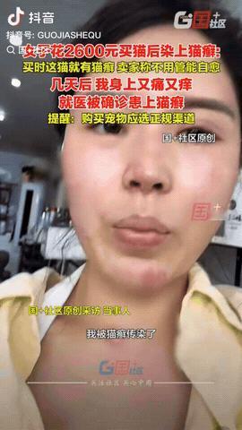 浙江嘉兴，一女子花2600元买了一只猫，不料，几天后她的身上又痛又痒，去医院就医
