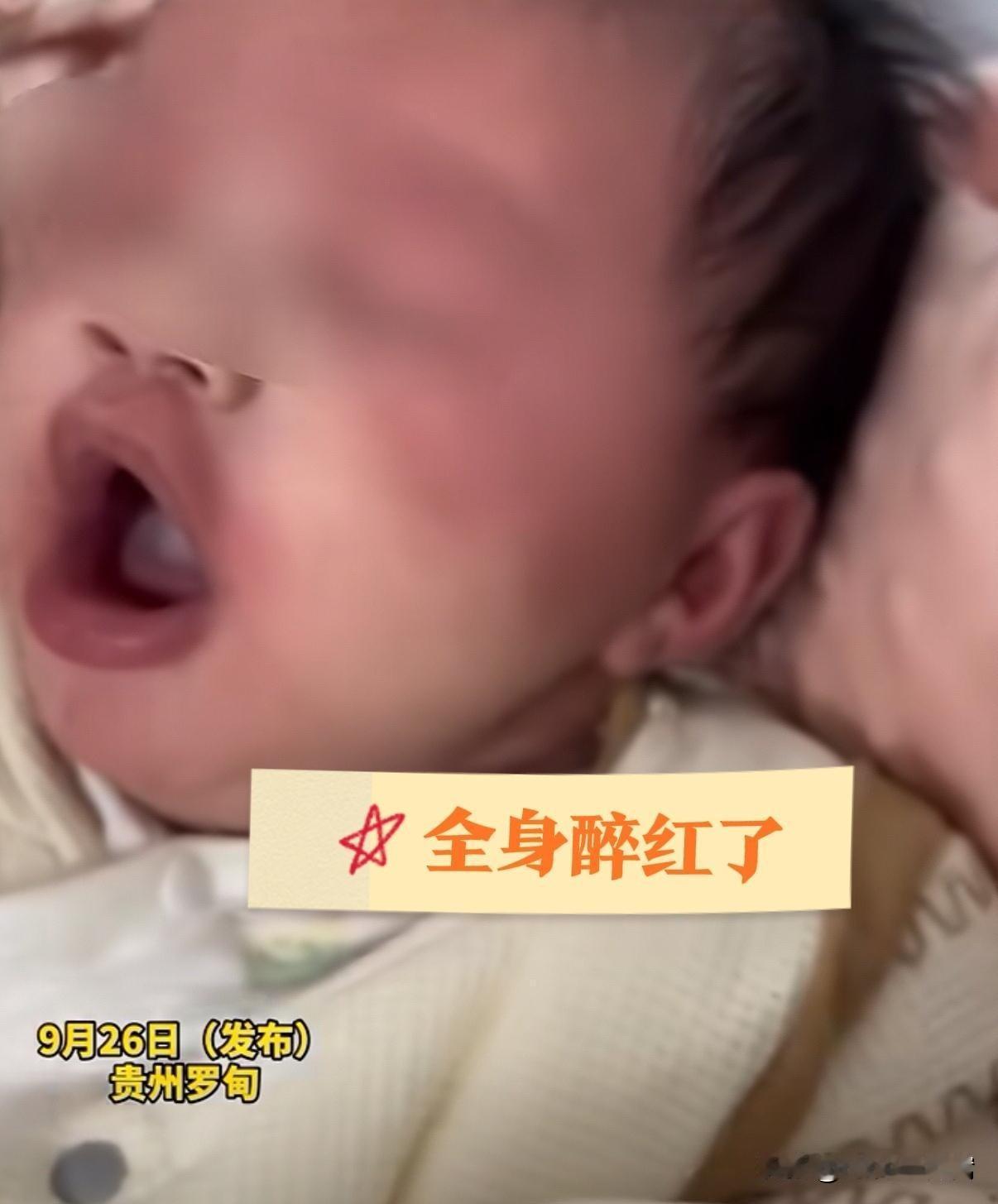 “这宝宝福大命硬啊！”  才1个多月大，就被自己的奶奶“快半斤白酒”灌得全身通红