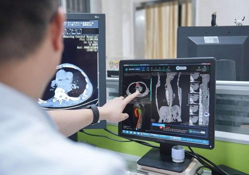 中国 AI 医生火了！单日抵 150 名病理专家，15 国引进宫颈癌筛查黑科技