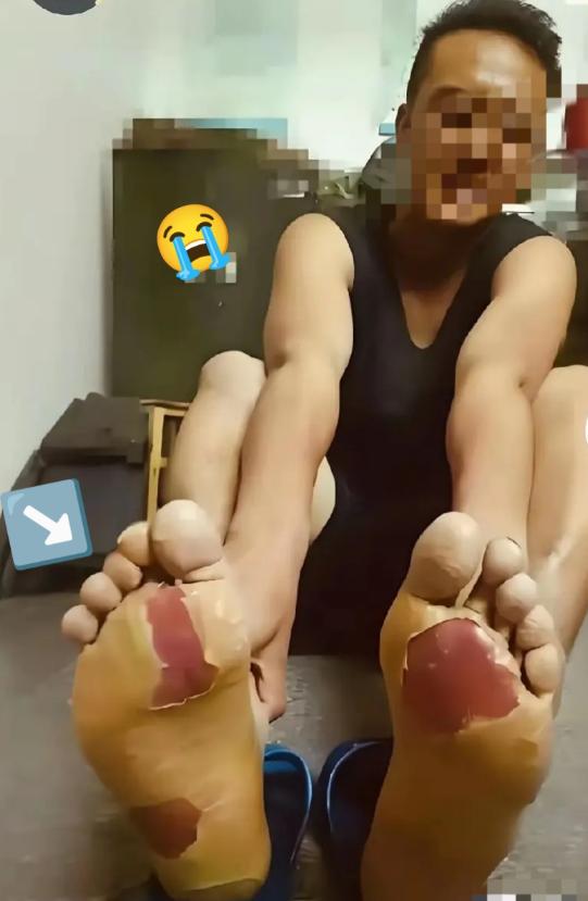 九三阅兵的战士归来，当众人看到他的双脚我瞬间泪目了！
 
9月3日，那场纪念中国
