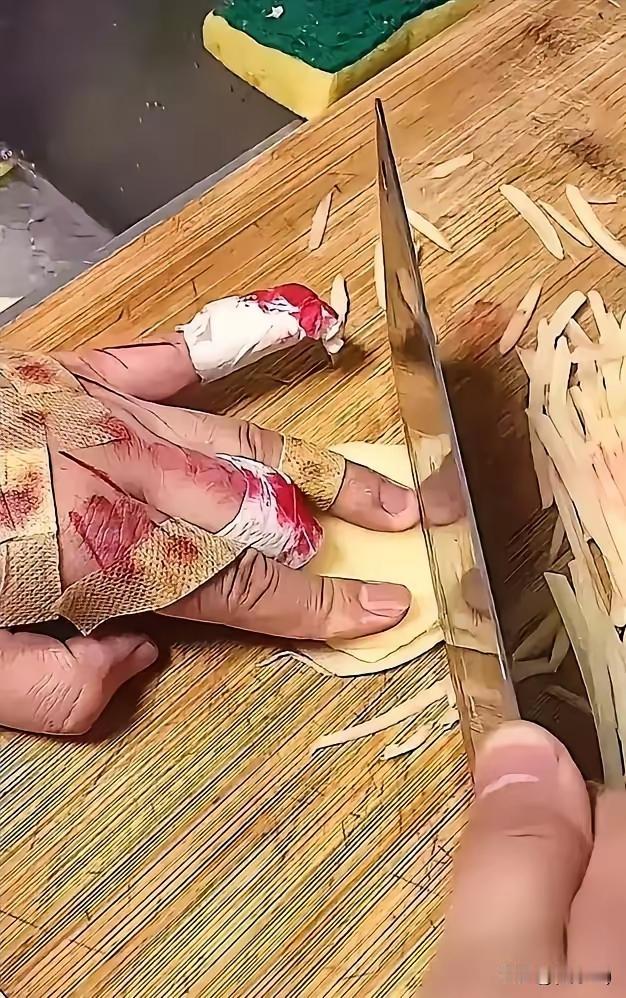 怎么这么不小心，你看，都切到土豆了[捂脸][捂脸]