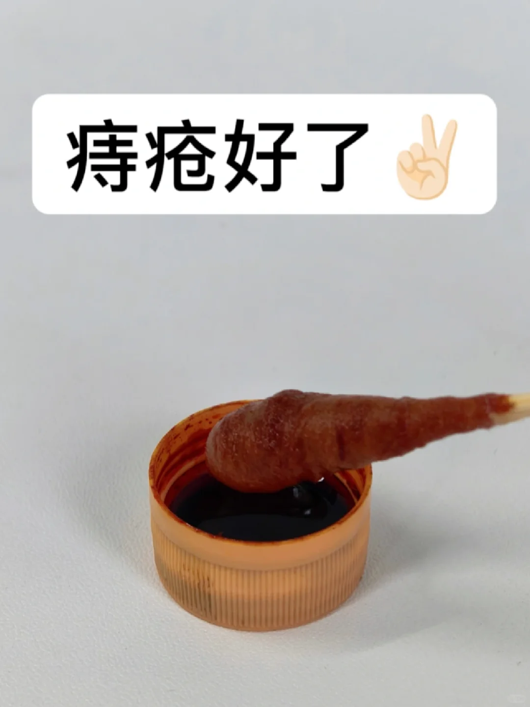 重度痔疮过来人的大实话：教会一个是一个