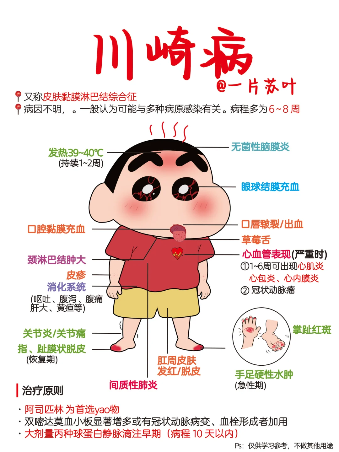 护士笔记✅川崎病📕儿科护理学‼️