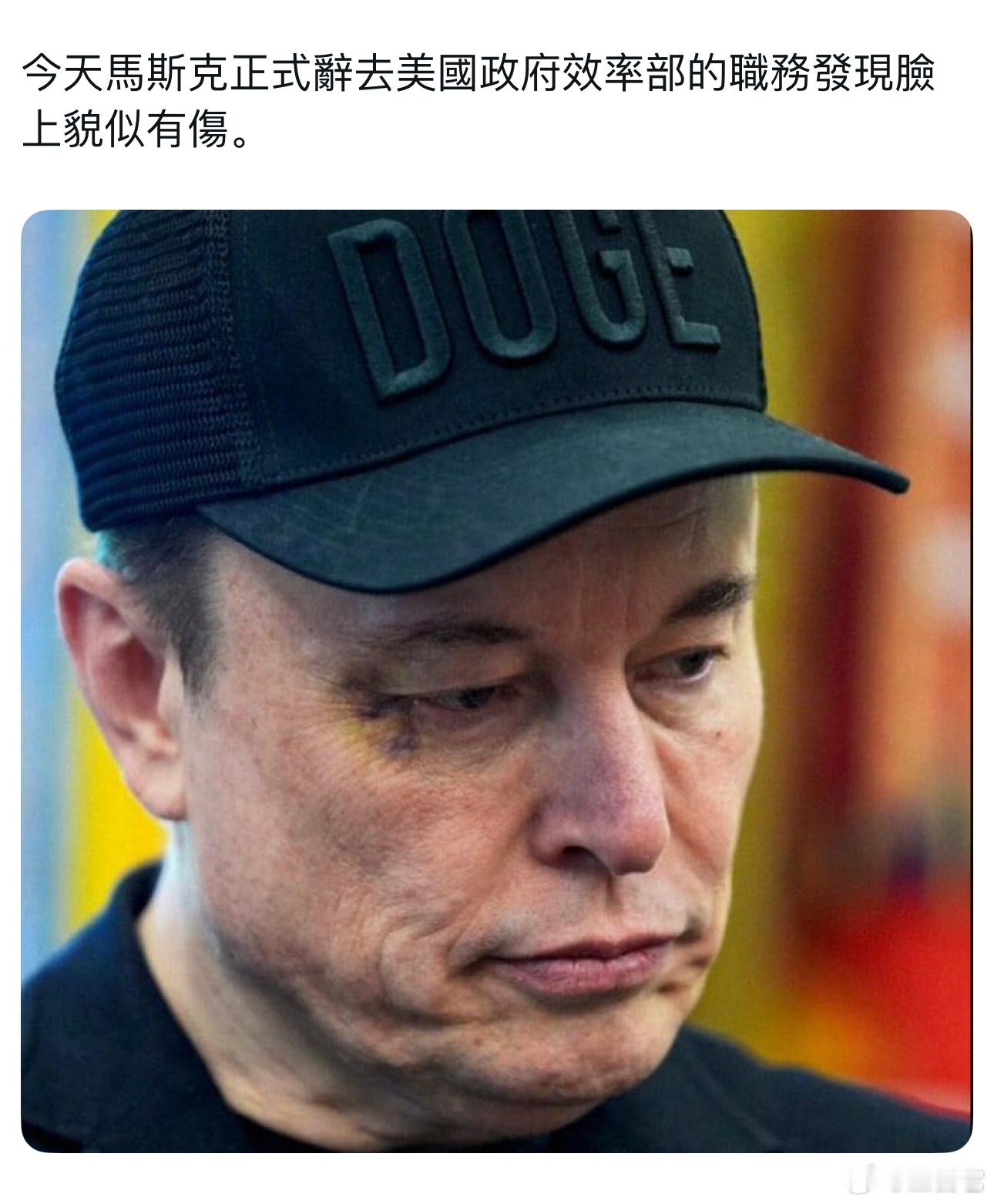 马斯克被儿子打了 ​​​