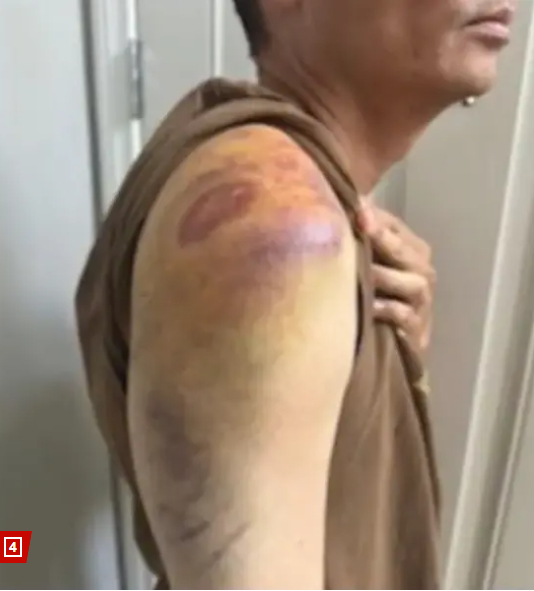 #遭警员殴打美ICE探员提正式诉讼#【#美ICE高级探员遭警员殴打#：将硬刚，正