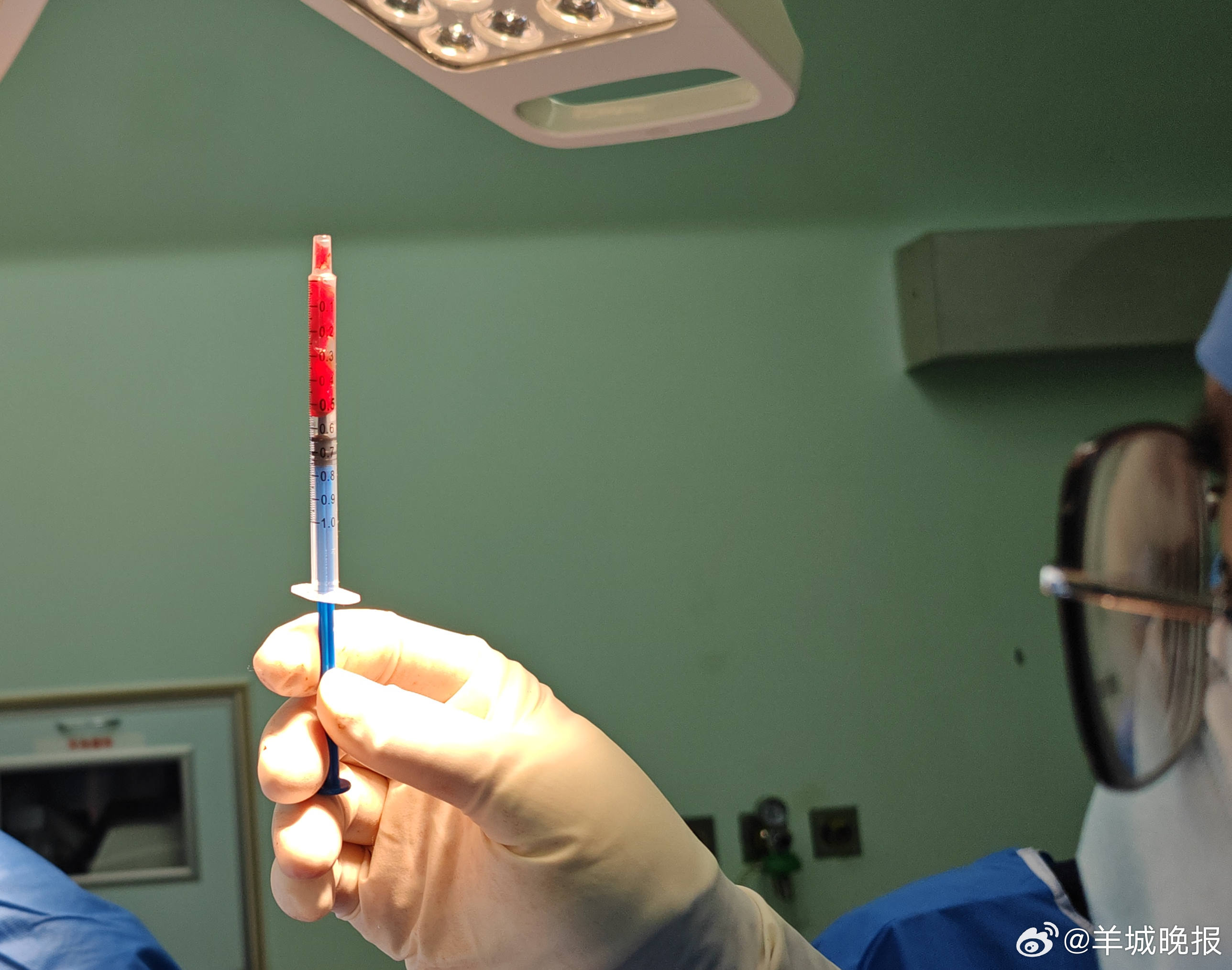 【#患者感染细菌排出草莓奶昔般脓液#】 近日，广州一患者因腰痛伴随近40摄氏度高