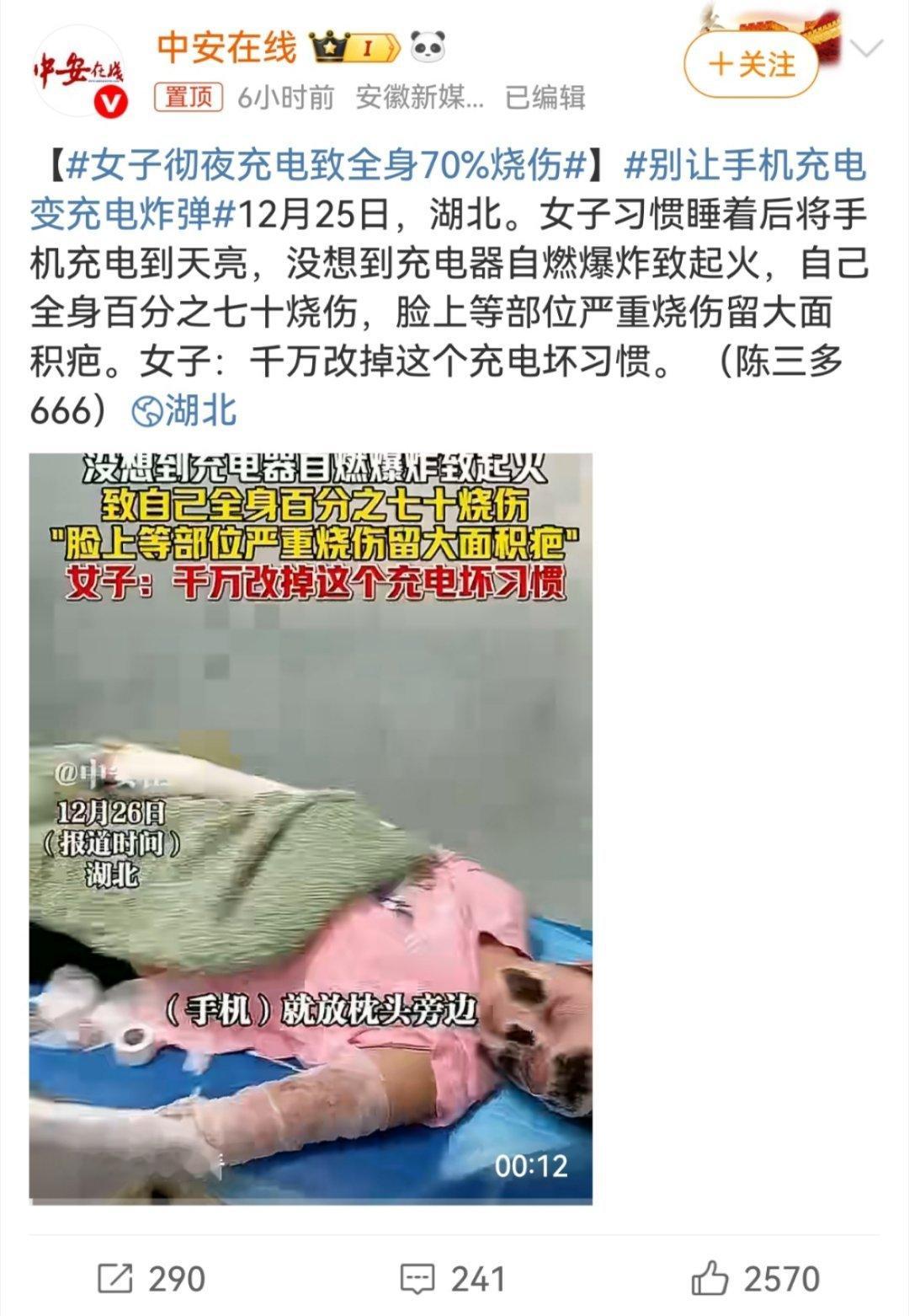 女子彻夜充电致全身70%烧伤建议手机充满就拔。但只要是正规品牌的手机、原厂适配充