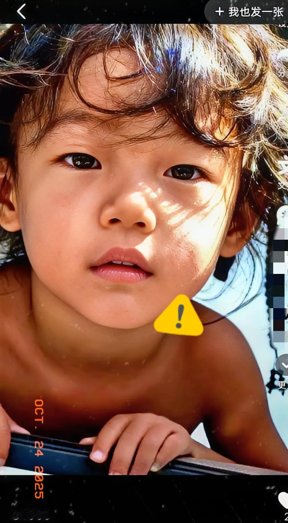 云南这个孩子太可怜了，呼吁大家一起救救这个孩子吧太可怜了，她本是一个很正常的孩子