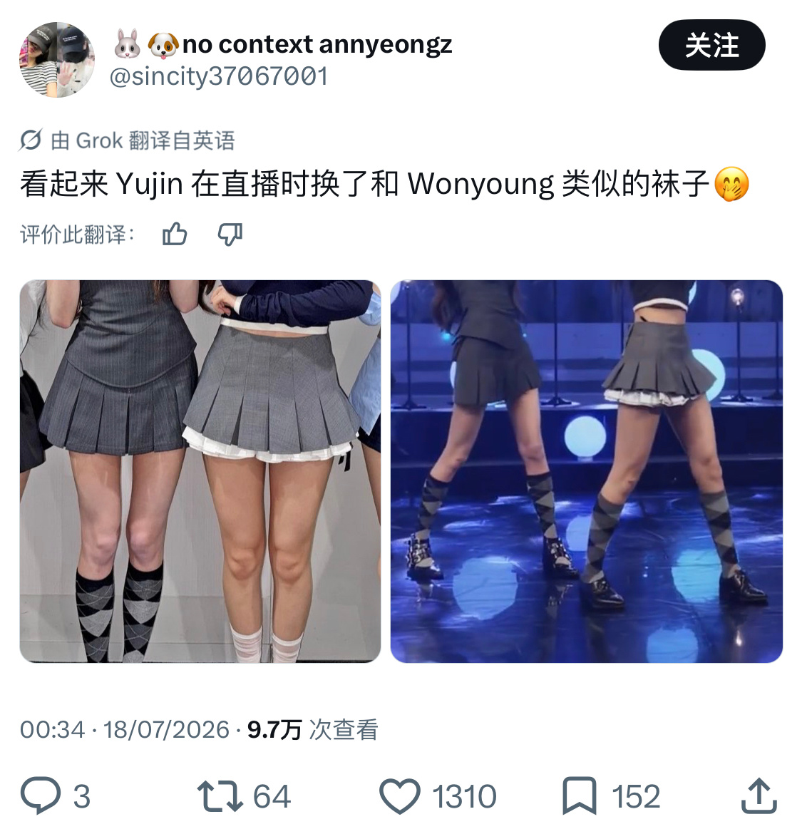 我只看到了安宥真一条顶老乱两条的猪腿 