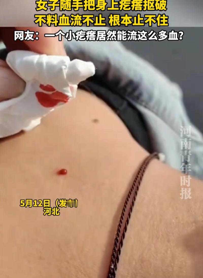 河北，一位姑娘跟身上一个小疙瘩较上了劲。她发现皮肤上冒了个不起眼的小东西，没忍住