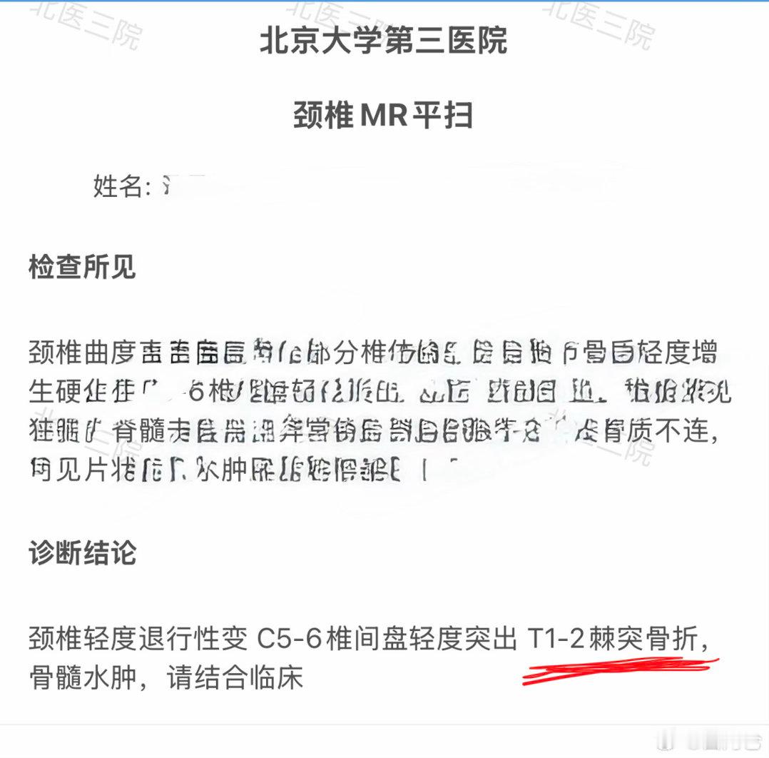 不服老不行…拖拽重物，导致脊椎棘突骨折。当时就感觉触电一样的疼，某个特定姿势就格