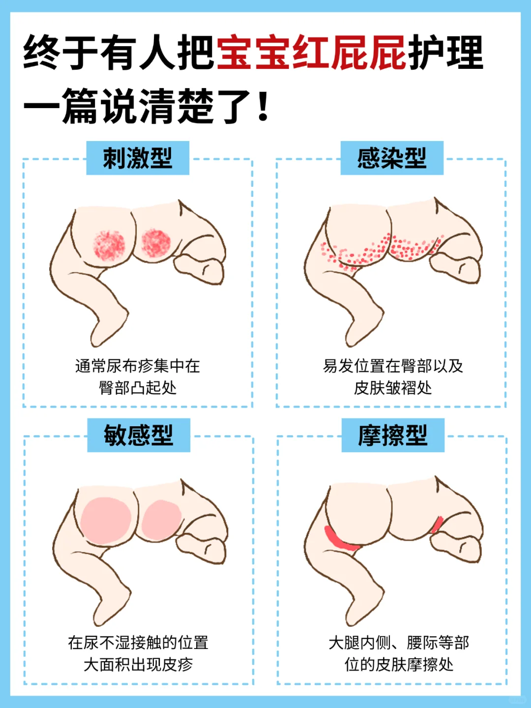 终于有人把宝宝红屁屁护理一篇说清楚！