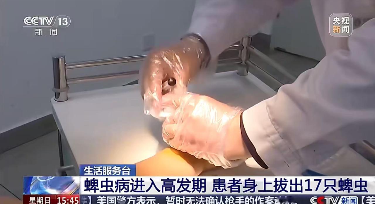 蜱虫最喜欢叮咬的部位是哪里？
 
春夏一到，草丛树林里藏着的吸血小恶魔蜱虫就开始