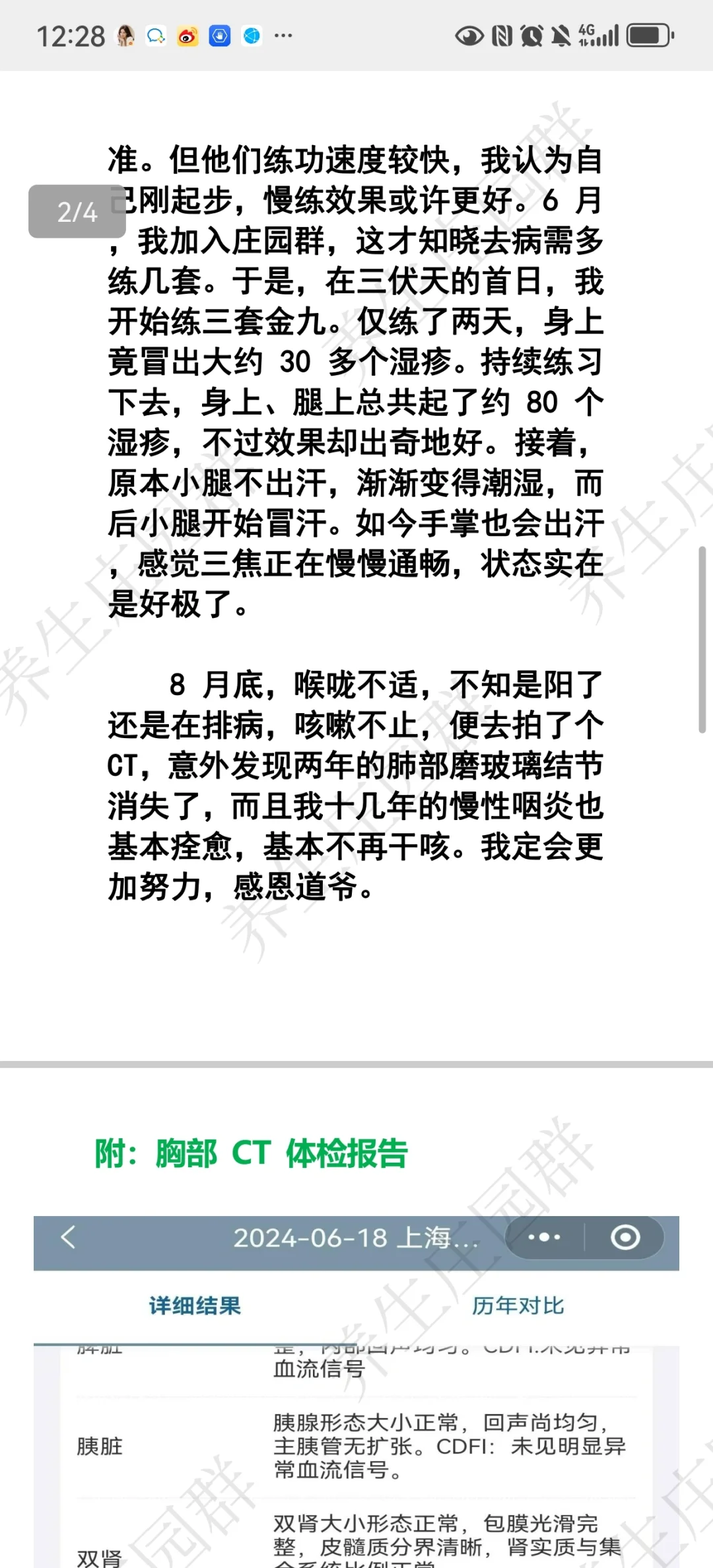范师兄多套练功fei结节练好案例
