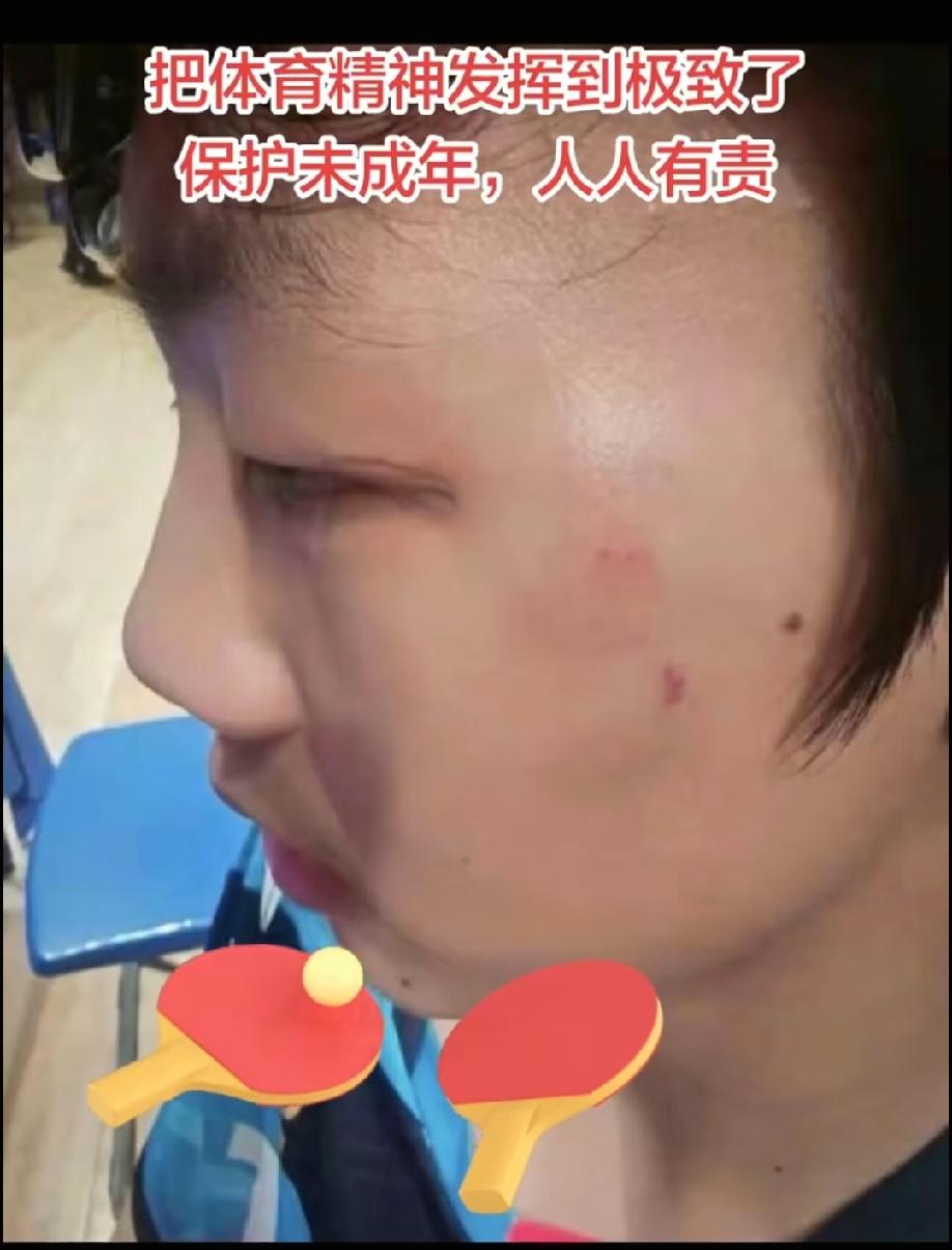 曹彦灏殴打对手，给所有体育圈的人提了个醒，
比赛输了不要紧，但不要输了自己的尊严