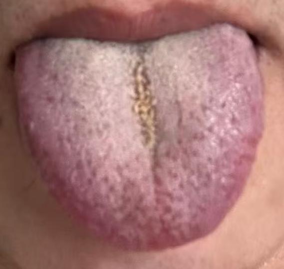 控制力差难以自持，别只盯着补肾，根源或是脾肾阳虚






不少男士遇到能力欠