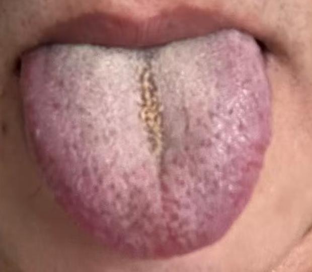 痰湿内停，气血运行不畅，郁热扰动宗筋






不少二十多岁的年轻人深受困扰，