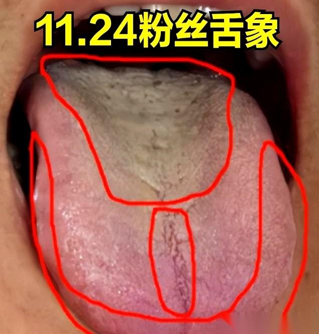 最怕的不是你身体差，是你身体成了一个“漏勺”。
吃什么都补不进去，全漏了。
还漏