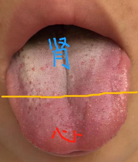 心肾不交的根源在：中焦不通

心和小肠相表里，心脏搏动产生的热经由中焦，向下传导