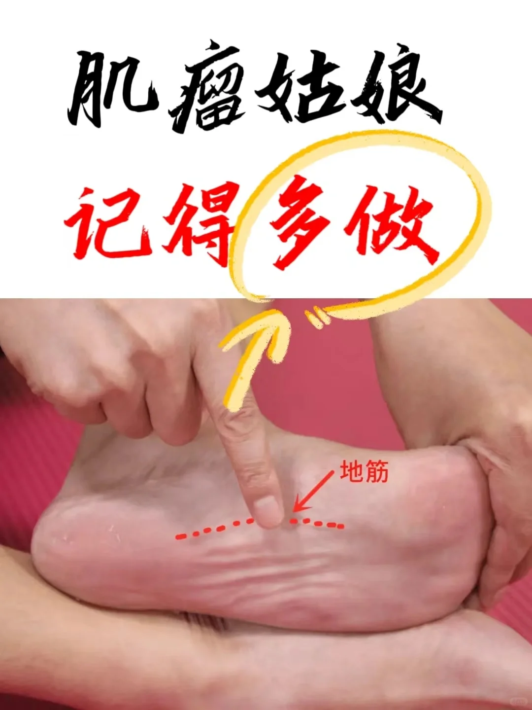 肌瘤姑娘，记得多吃这4种食物，养成8大习惯