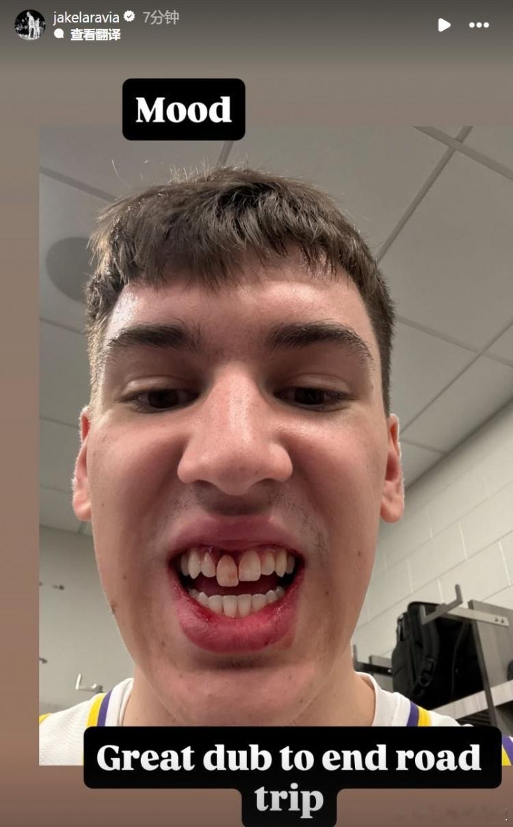 🦷被撞掉了？拉拉维亚晒出照片写道：“为客场之旅画上圆满句号。” 