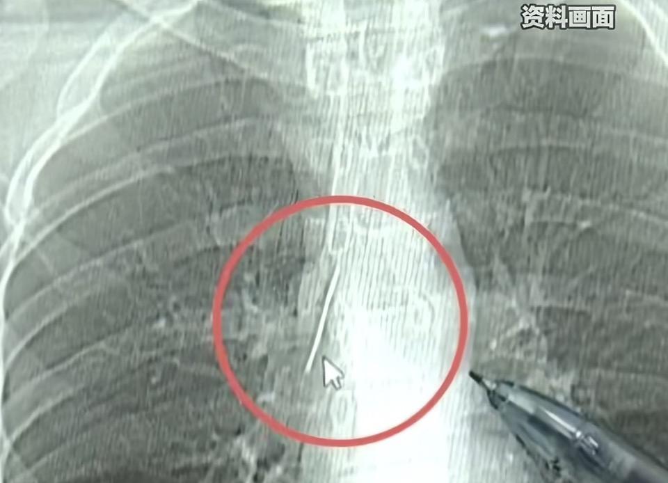 我的今日状态：😎自信酷炫
我这里的天气：🍂微风