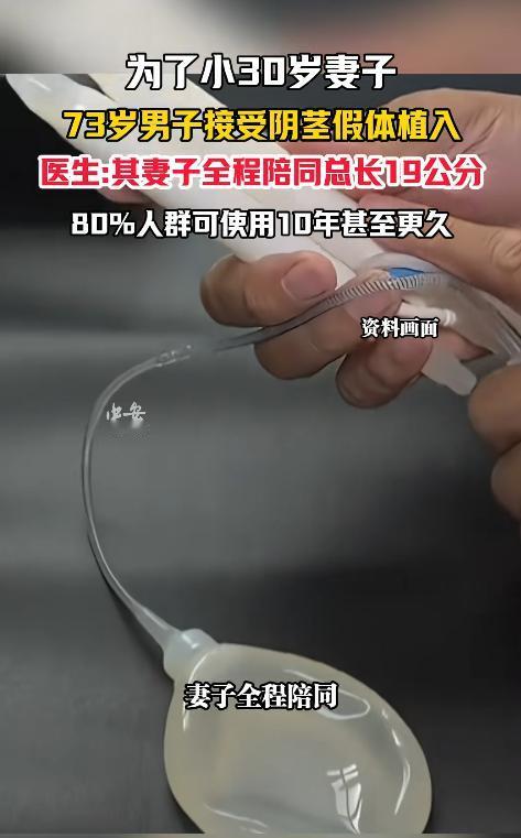 “这大爷是真敢！”一位73岁的老人，为改善与小30多岁妻子的夫妻生活，选择接受阴
