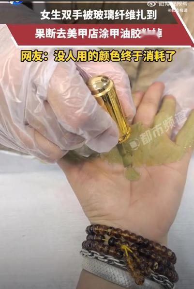 这是真聪明！浙江，一女生双手被玻璃纤维扎到，可她既没有自己拔，没有去医院，而是走